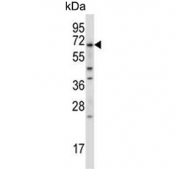 Western blot testing of human MDA-MB-435 cell lysate with BIRC3 antibody. Predicted molecular weight ~68 kDa.