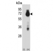 Western blot testing of 1) non-transfected and 2) transfected 293 cell lysate with BIRC3 antibody. Predicted molecular weight ~68 kDa.