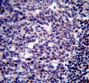 IHC testing of FFPE human tonsil tissue with BIRC3 antibody. HIER: steam section in pH6 citrate buffer for 20 min and allow to cool prior to staining.