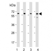 Western blot testing of 1) human CCRF-CEM, 2) human HepG2, 3) human K562 and 4) mouse Ba/F3 cell lysate with DYRK2 antibody. Predicted molecular weight ~67 kDa.
