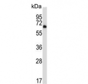 Western blot testing of human K562 cell lysate with DYRK2 antibody. Predicted molecular weight ~67 kDa.