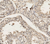 IHC testing of FFPE human testis tissue with DYRK2 antibody. HIER: steam section in pH6 citrate buffer for 20 min and allow to cool prior to staining.