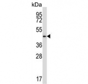 Western blot testing of human HepG2 cell lysate with Pyruvate dehydrogenase kinase 2 antibody. Predicted molecular weight ~46 kDa.