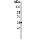Western blot testing of human T-47D cell lysate with NANOS1 antibody. Predicted molecular weight: ~30 kDa but routinely observed at 35~40 kDa.