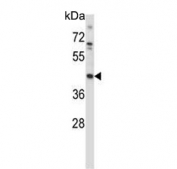 Western blot testing of human MDA-MB-435 cell lysate with MEK1 antibody. Predicted molecular weight ~43 kDa.