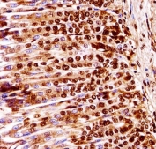 IHC testing of FFPE mouse stomach tissue with MEK1 antibody. HIER: steam section in pH6 citrate buffer for 20 min and allow to cool prior to staining.
