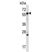 Western blot testing of mouse stomach tissue lysate with OXSR1 antibody. Predicted molecular weight ~58 kDa.