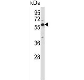 Western blot testing of human K562 cell lysate with OXSR1 antibody. Predicted molecular weight ~58 kDa.