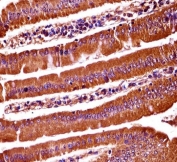 IHC testing of FFPE mouse duodenum tissue with OXSR1 antibody. HIER: steam section in pH6 citrate buffer for 20 min and allow to cool prior to staining.