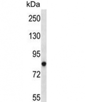 Western blot testing of human Jurkat cell lysate with PRKCA antibody. Predicted molecular weight ~77 kDa.