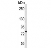 Western blot testing of mouse Neuro-2a cell lysate with PRKCA antibody. Predicted molecular weight ~77 kDa.