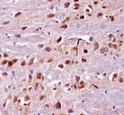 IHC testing of FFPE mouse brain tissue with PRKCA antibody. HIER: steam section in pH6 citrate buffer for 20 min and allow to cool prior to staining.