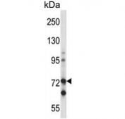 Western blot testing of human Jurkat cell lysate with c-Raf antibody. Predicted molecular weight ~73 kDa.