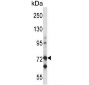 Western blot testing of human Jurkat cell lysate with c-Raf antibody. Predicted molecular weight ~73 kDa.