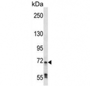 Western blot testing of mouse Neuro-2a cell lysate with c-Raf antibody. Predicted molecular weight ~73 kDa.