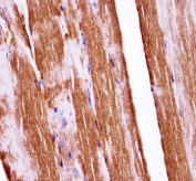 IHC testing of FFPE mouse skeletal muscle tissue with c-Raf antibody. HIER: steam section in pH6 citrate buffer for 20 min and allow to cool prior to staining.