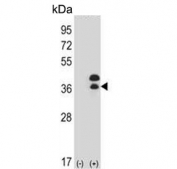 Western blot testing of 1) non-transfected and 2) transfected 293 cell lysate with DLX5 antibody. Predicted molecular weight ~32 kDa.