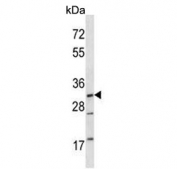 Western blot testing of mouse NIH 3T3 cell lysate with MAP2K3 antibody. Expected molecular weight: 36-39 kDa (two isoforms). 