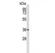 Western blot testing of human MCF7 cell lysate with MAP2K3 antibody. Expected molecular weight: 36-39 kDa (two isoforms). 