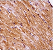 IHC testing of FFPE mouse heart tissue with Mekkk3 antibody. HIER: steam section in pH6 citrate buffer for 20 min and allow to cool prior to staining.