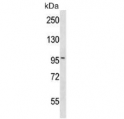 Western blot testing of human HepG2 cell lysate with Mekkk3 antibody. Predicted molecular weight ~101 kDa.