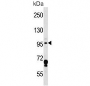Western blot testing of mouse Neuro-2a cell lysate with Mekkk3 antibody. Predicted molecular weight ~101 kDa.