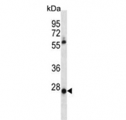 Western blot testing of human HepG2 cell lysate with MOX-1 antibody. Predicted molecular weight ~28 kDa.