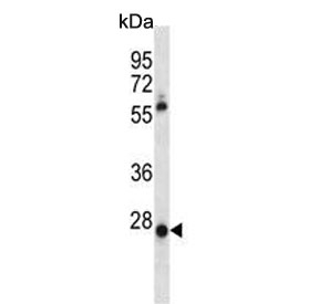 Western blot testing of human HepG2 cell lysate with MOX-1 antibody. Predicted molecular weight ~28 kDa.