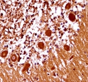 IHC testing of FFPE human cerebellum tissue with MOX-1 antibody. HIER: steam section in pH6 citrate buffer for 20 min and allow to cool prior to staining.