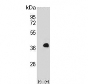 Western blot testing of 1) non-transfected and 2) transfected 293 cell lysate with MOX-1 antibody. Predicted molecular weight ~28 kDa.