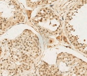 IHC testing of FFPE human testis tissue with CCR4-NOT transcription complex subunit 4 antibody. HIER: steam section in pH6 citrate buffer for 20 min and allow to cool prior to staining.