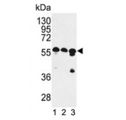 Western blot testing of human 1) MCF7, 2) K562 and 3) HEK293 cell lysate with CCR4-NOT transcription complex subunit 4 antibody. Expected molecular weight: 48-84 kDa (multiple isoforms).