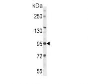 Western blot testing of mouse bladder tissue lysate with Phospholipase D2 antibody. Predicted molecular weight ~106 kDa.