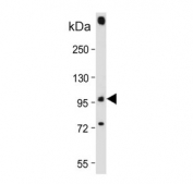 Western blot testing of mouse lung tissue lysate with Phospholipase D2 antibody. Predicted molecular weight ~106 kDa.