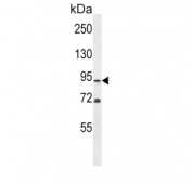 Western blot testing of human MDA-MB-453 cell lysate with Phospholipase D2 antibody. Predicted molecular weight ~106 kDa.