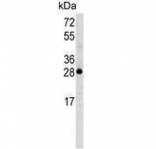 Western blot testing of human HL60 cell lysate with Latexin antibody. Predicted molecular weight ~26 kDa.