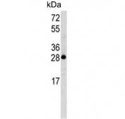 Western blot testing of human HL60 cell lysate with Latexin antibody. Predicted molecular weight ~26 kDa.