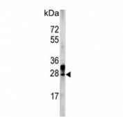 Western blot testing of human K562 cell lysate with ERAS antibody. Predicted molecular weight ~25 kDa.