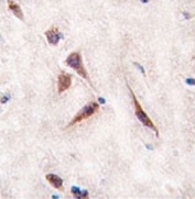 IHC testing of FFPE human brain tissue with ERAS antibody. HIER: steam section in pH6 citrate buffer for 20 min and allow to cool prior to staining.