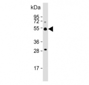 Western blot testing of human liver lysate with ALDH5A1 antibody. Predicted molecular weight ~57 kDa.