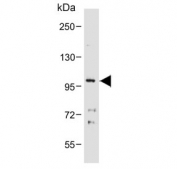 Western blot testing testing of rat C6 cell lysate with Cadherin 10 antibody. Predicted molecular weight ~88 kDa but may be observed at higher molecular weights due to glycosylation.