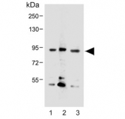 Western blot testing testing of 1) human SK-BR-3, 2) human NCI-H460 and 3) mouse F9 cell lysate with Cadherin 10 antibody. Predicted molecular weight ~88 kDa but may be observed at higher molecular weights due to glycosylation.
