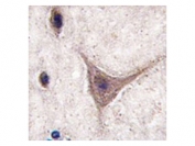 IHC testing of FFPE human brain tissue with Cadherin 10 antibody. HIER: steam section in pH6 citrate buffer for 20 min and allow to cool prior to staining.