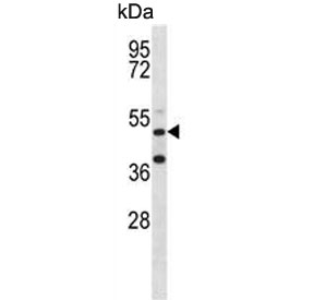 Western blot testing of human Jurkat cell lysate with RBM22 antibody. Predicted molecular weight ~47 kDa.