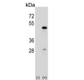 Western blot testing of 1) non-transfected and 2) transfected 293 cell lysate with RBM22 antibody. Predicted molecular weight ~47 kDa.