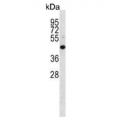 Western blot testing of mouse NIH 3T3 cell lysate with MEK4 antibody. Predicted molecular weight ~44 kDa.