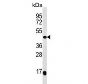 Western blot testing of human Y79 cell lysate with MEK4 antibody. Predicted molecular weight ~44 kDa.