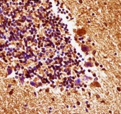 IHC testing of FFPE mouse cerebellum tissue with MEK4 antibody. HIER: steam section in pH6 citrate buffer for 20 min and allow to cool prior to staining.