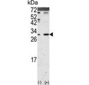 Western blot testing of 1) non-transfected and 2) transfected 293 cell lysate with Dickkopf-2 antibody. Expected molecular weight: 28-35 kDa.