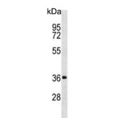 Western blot testing of mouse brain tissue lysate with Dickkopf-2 antibody. Expected molecular weight: 28-35 kDa.